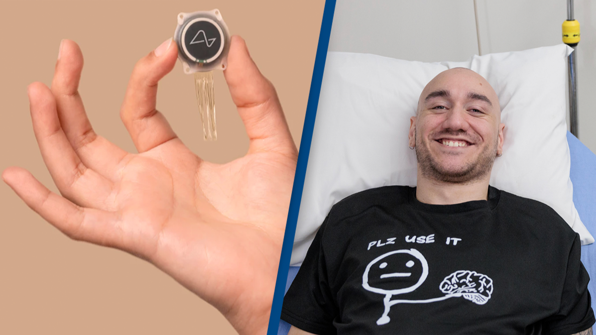 Elon Musk's Neuralink shares update on first human to have brain implant  revealing wires are now 'stable' - News - UNILAD
