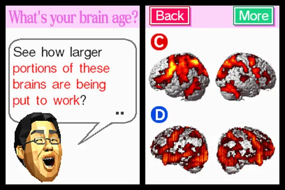 brainage.jpg