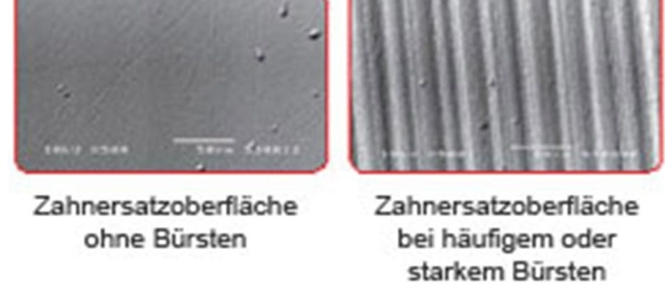 Besser als die Zahnbürste! Warum?