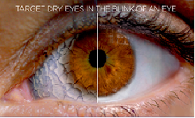 Putting contact lens in eye