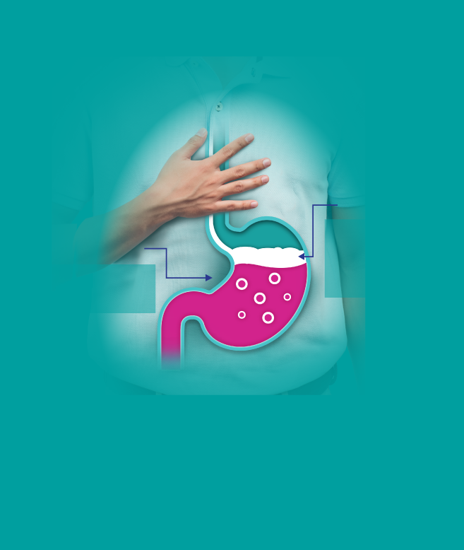 fast-effective-heartburn-indigestion-relief-gaviscon-sg