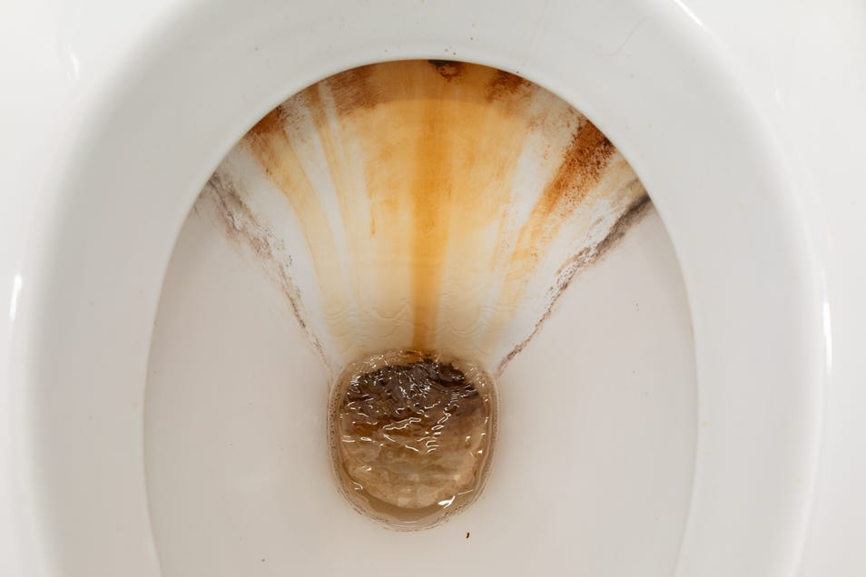 डीप क्लीन टॉयलेट बाउल