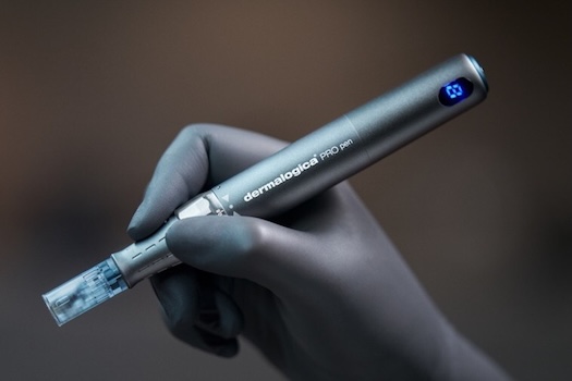 Microneedles: A Sting-Free Breakthrough
