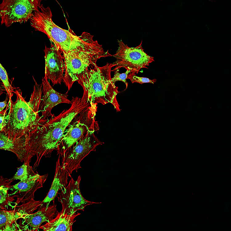 JJ_Photo_Micro Onc Metastatic cancer cells_Shutterstock_264871544_1Star JJ_Photo_Micro Onc Metastatic cancer cells_Shutterstock_264871544_1Star