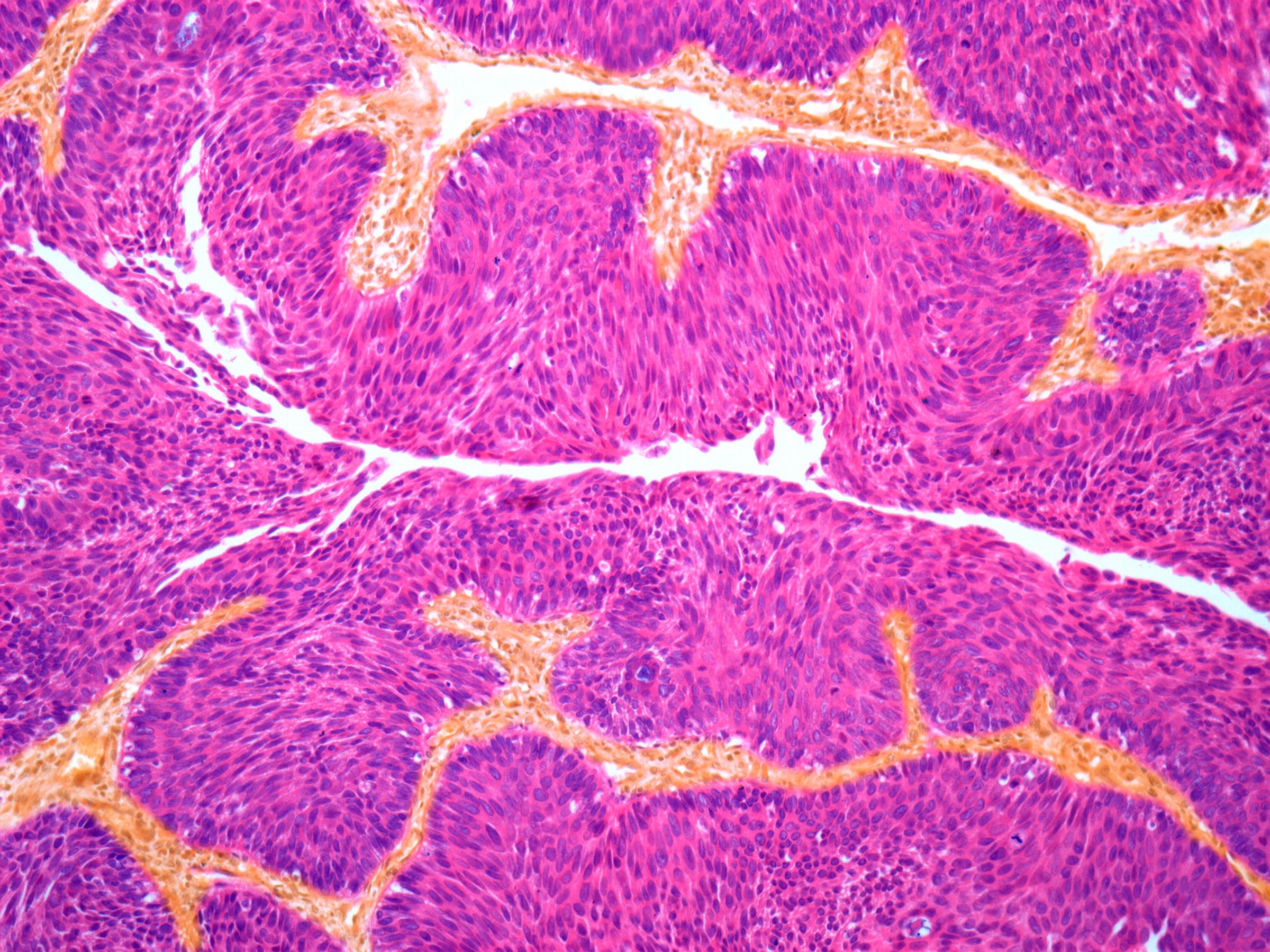 Medical Education in Bladder Cancer