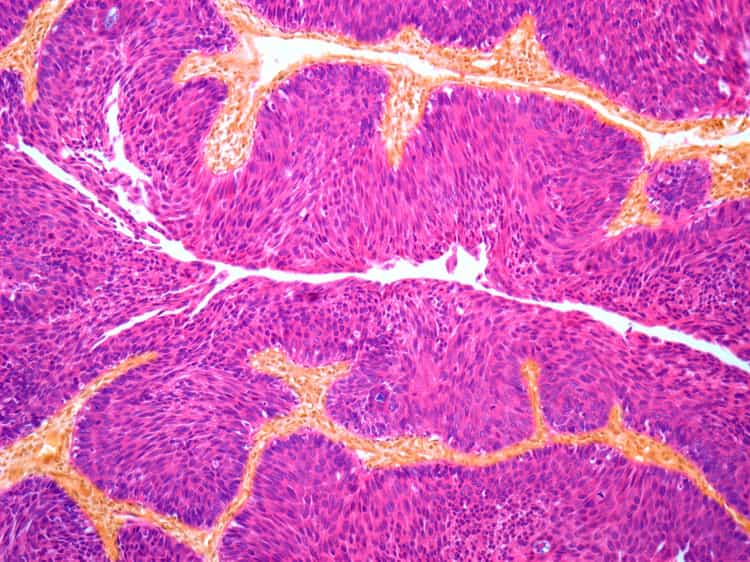 Medical Education in Bladder Cancer