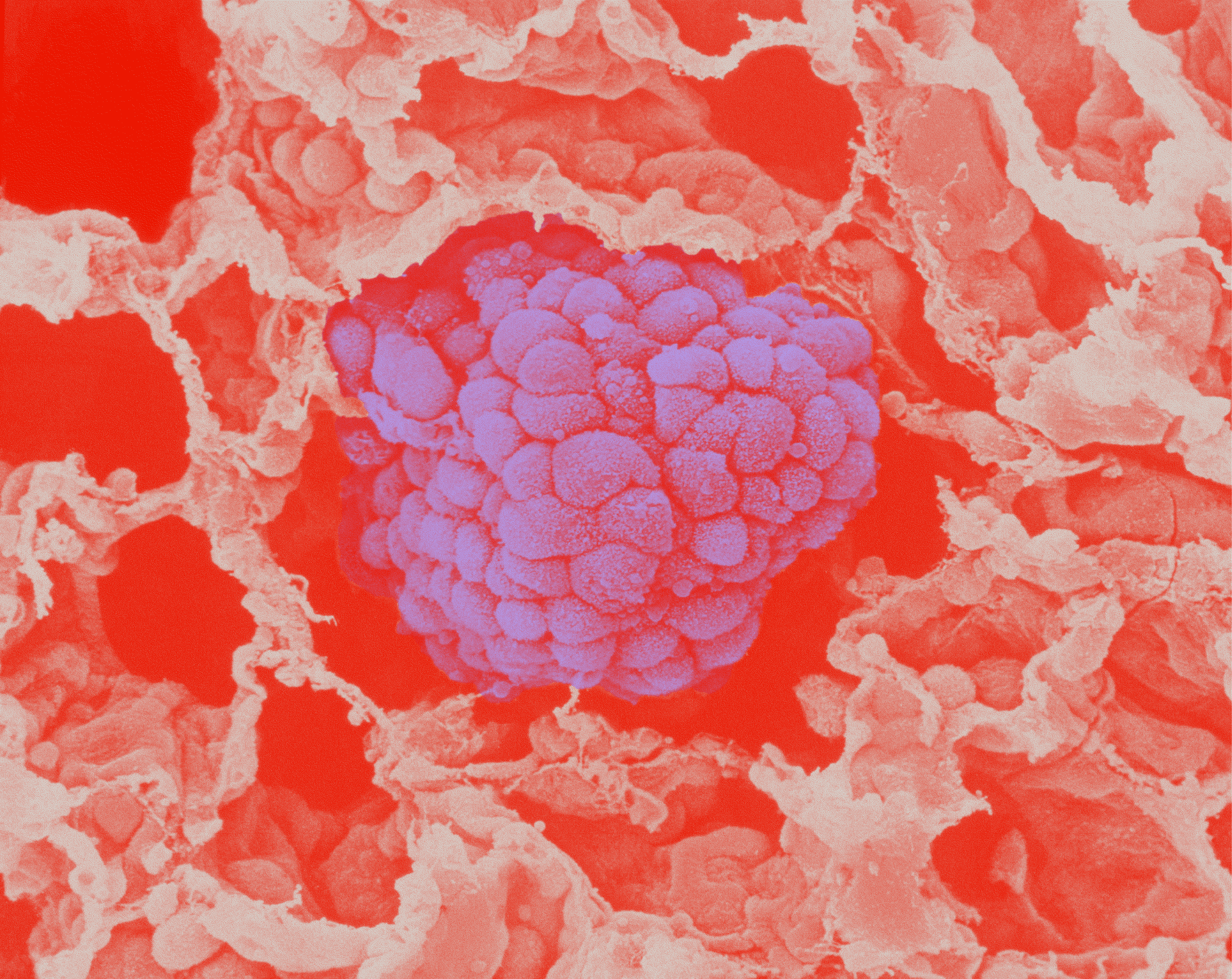 Medical Education in Lung Cancer