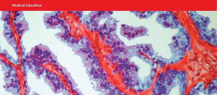 Medical Education in Prostate Cancer