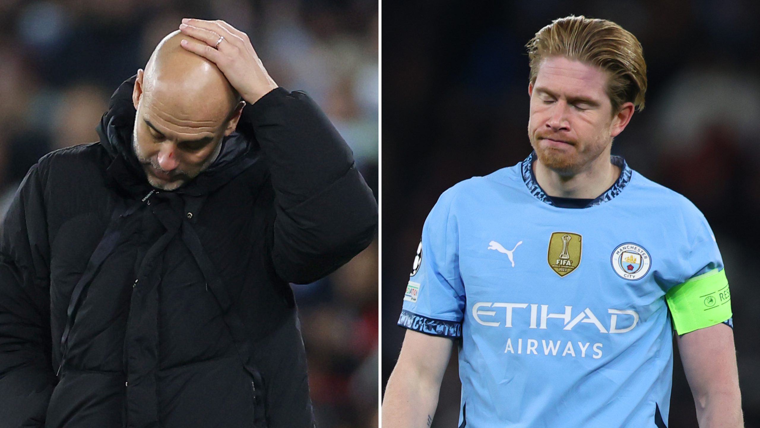 Pep Guardiola explains why he had scratches all over his face after Man  City's collapse against Feyenoord - Man City - SPORTbible