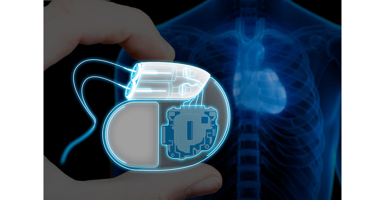 Fun Pacemaker Background 8 Fun Battery Facts You Probably Didn’t Know