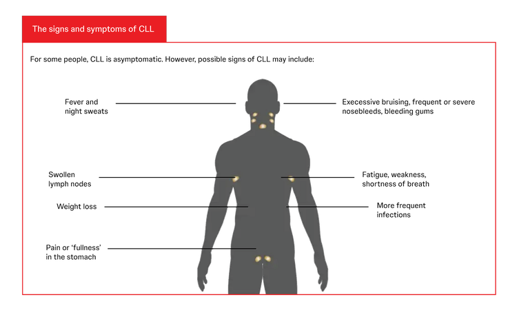 Symptoms of chronic lymphocytic leukaemia (CLL)