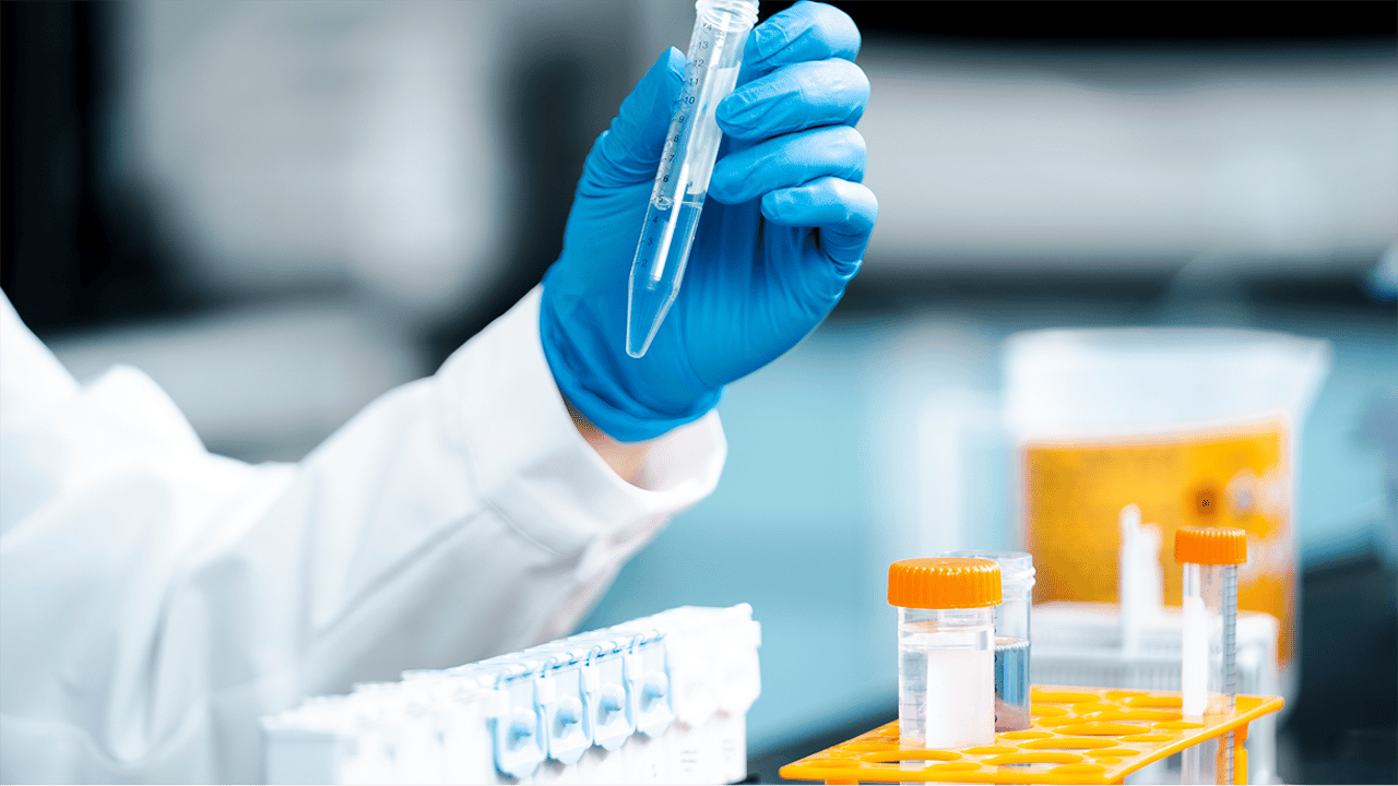 blood_and_stool_test