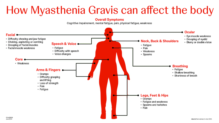 How Myasthenia Gravis can affect the body