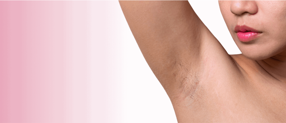 Body Hair Shaming : qu'est-ce que c'est ?
