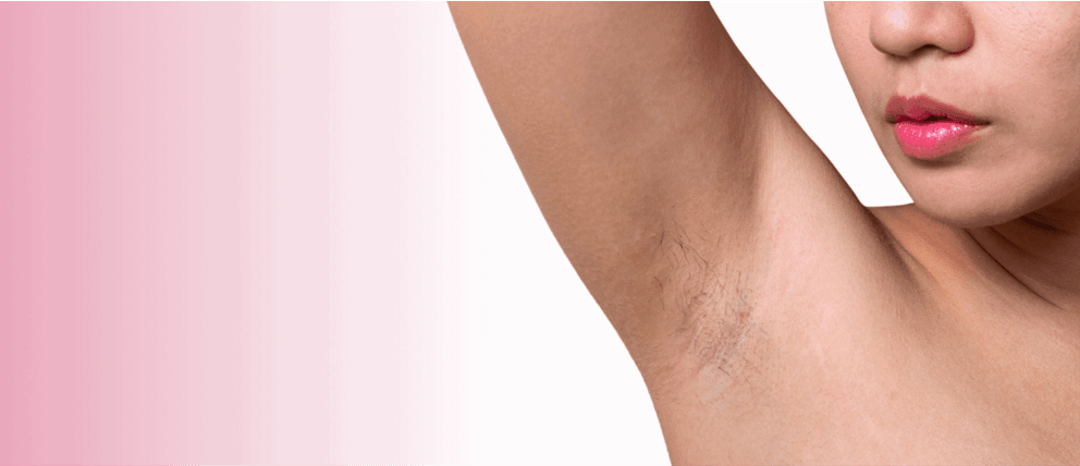 Body Hair Shaming : qu'est-ce que c'est ?