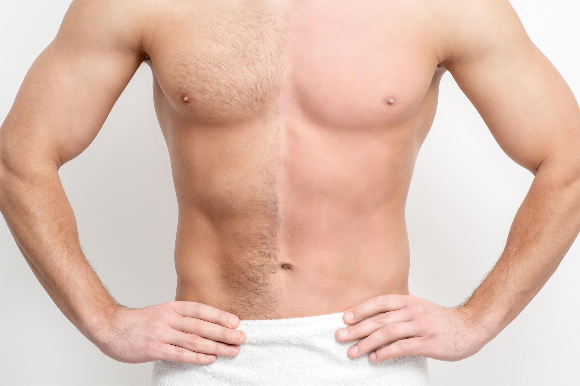 Bye Bye to Body Hair: Ways to Remove Unwanted Body Hair