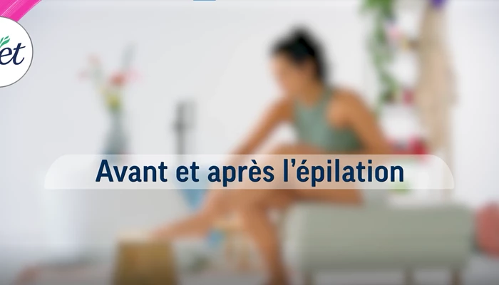 À quoi faut-il faire attention avant et après l`épilation?