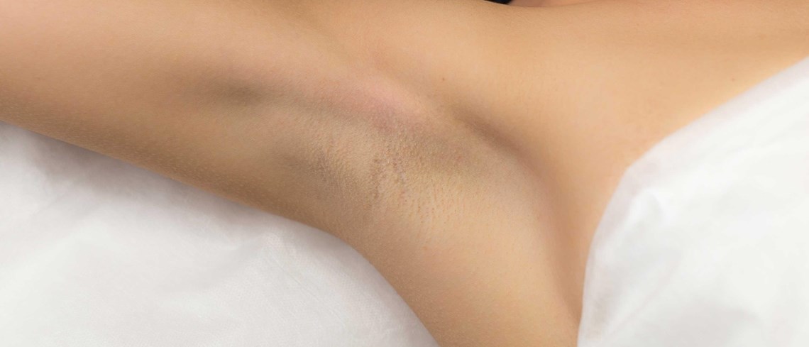 Body Hair Removal Guide