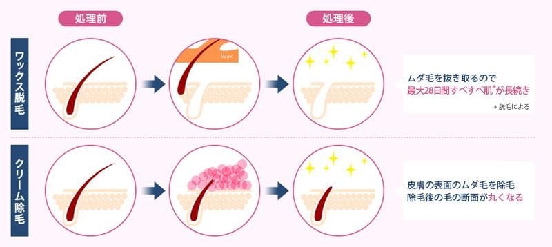 ヴィートとカミソリの違いは?
