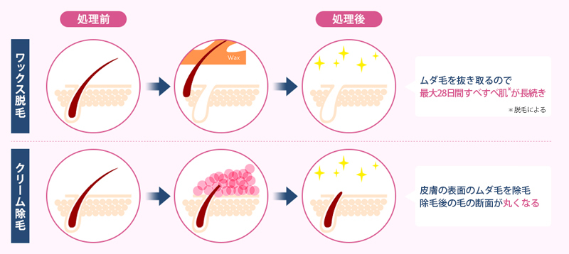 脱毛と除毛って何が違うの!?