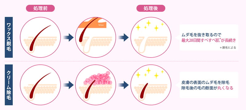 脱毛と除毛って何が違うの!?