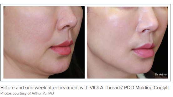 Picture of Browse Online Classes for Creatives | Skillshare