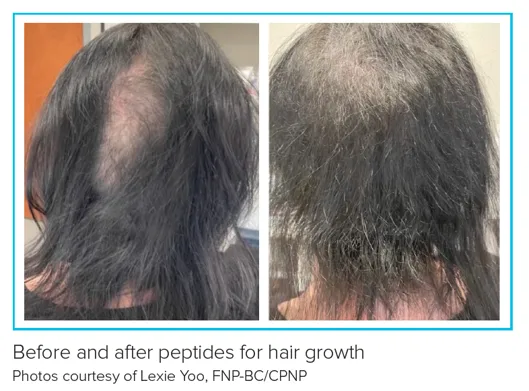 glutathione precursor benefits What is NAC? How can it help me? NAC therapy in Denver glutathione precursor benefits What is NAC? How can it help me? NAC therapy in Denver