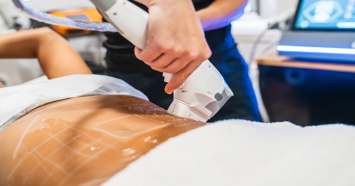 Body Treatments 2026: Skin, Shape & Beyond