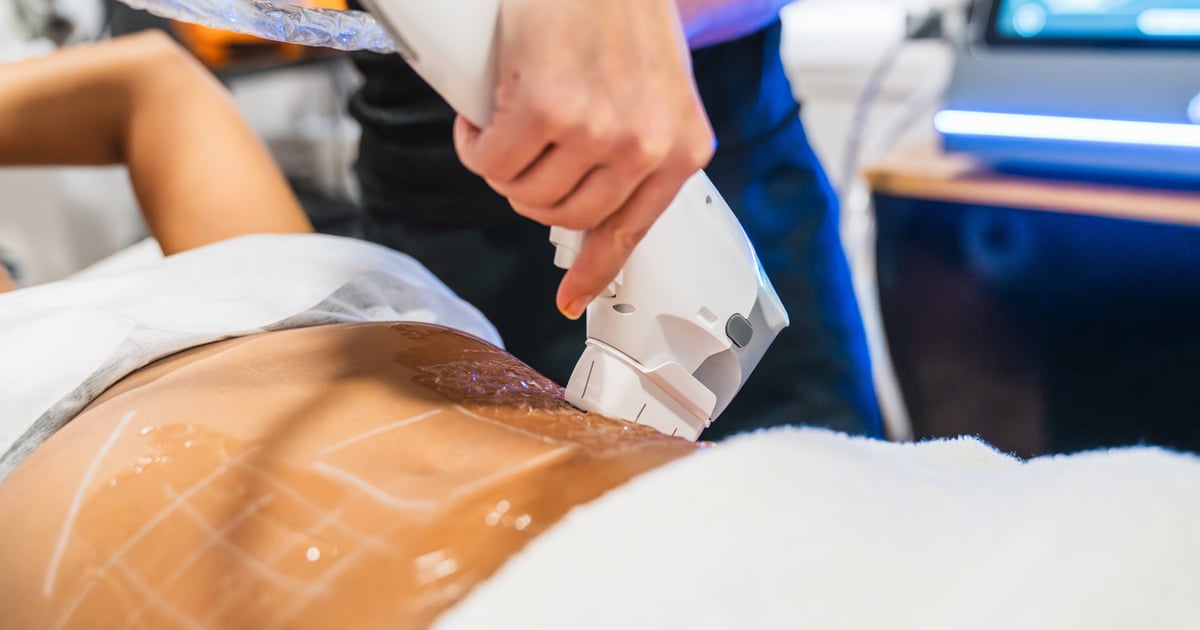 Body Treatments 2026: Skin, Shape & Beyond
