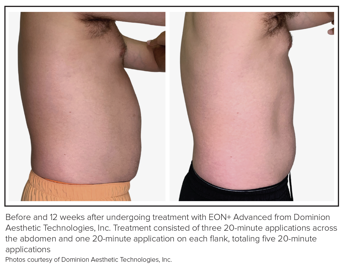 semaglutide mce FBI issues safety warning about counterfeit versions of weight loss drug  semaglutide