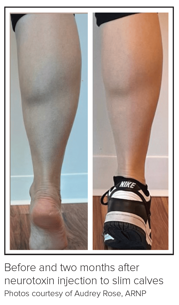 most effective dose of semaglutide for weight loss Semaglutide Beginning Dosage in New Braunfels, TX most effective dose of semaglutide for weight loss Semaglutide Beginning Dosage in New Braunfels, TX