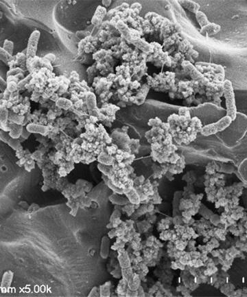 Study sheds light on Salmonella survival in food processing - Vimarsana News