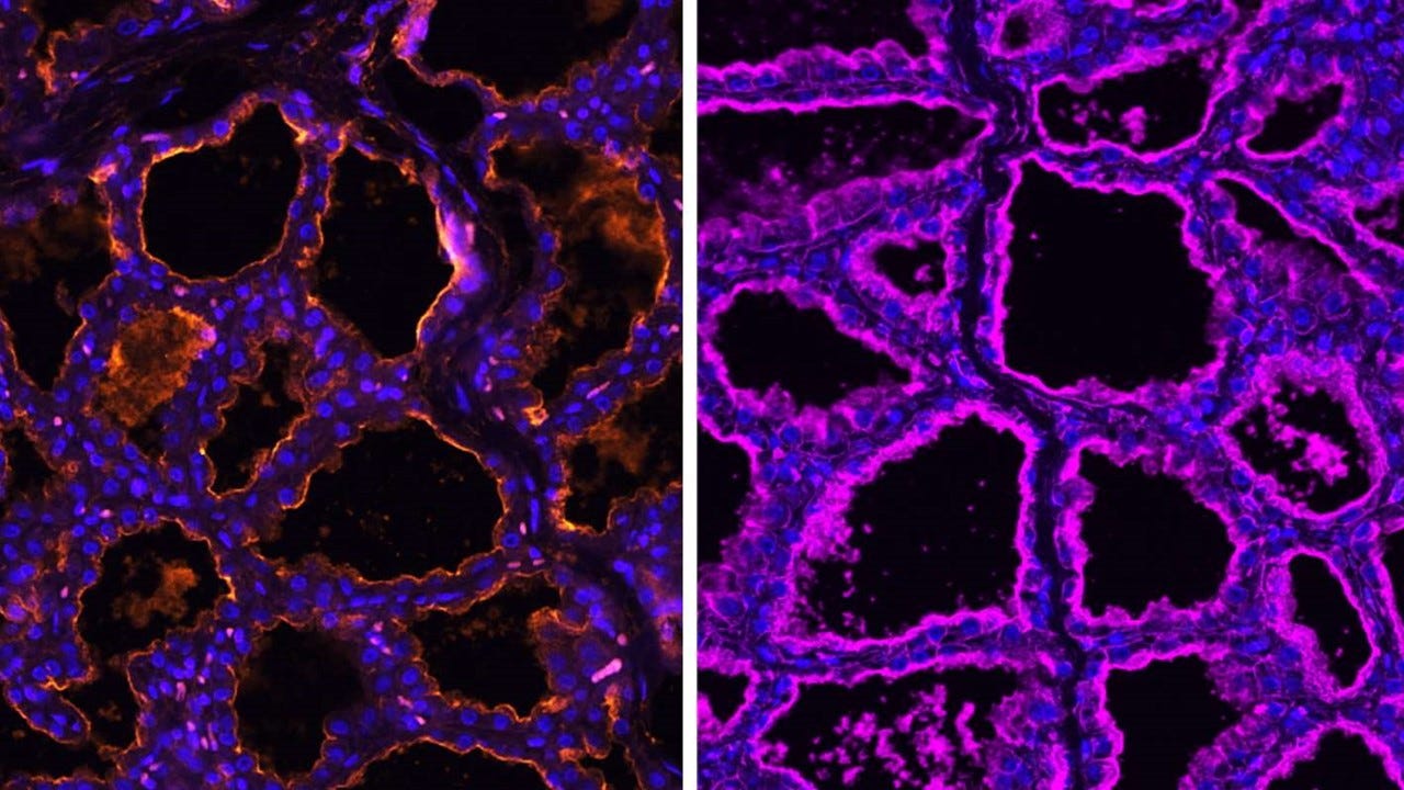 Mammary gland receptors indicate other livestock prone to H5N1