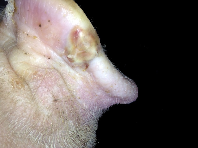 Pig snout lesion from Senecavirus