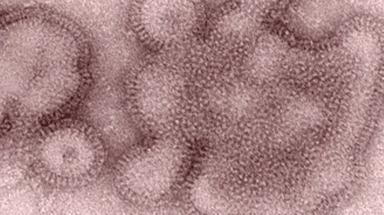 CDC  Provides Details about Mild H3N2v Flu Strain