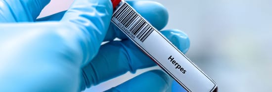 Laboratorista revisando prueba de herpes