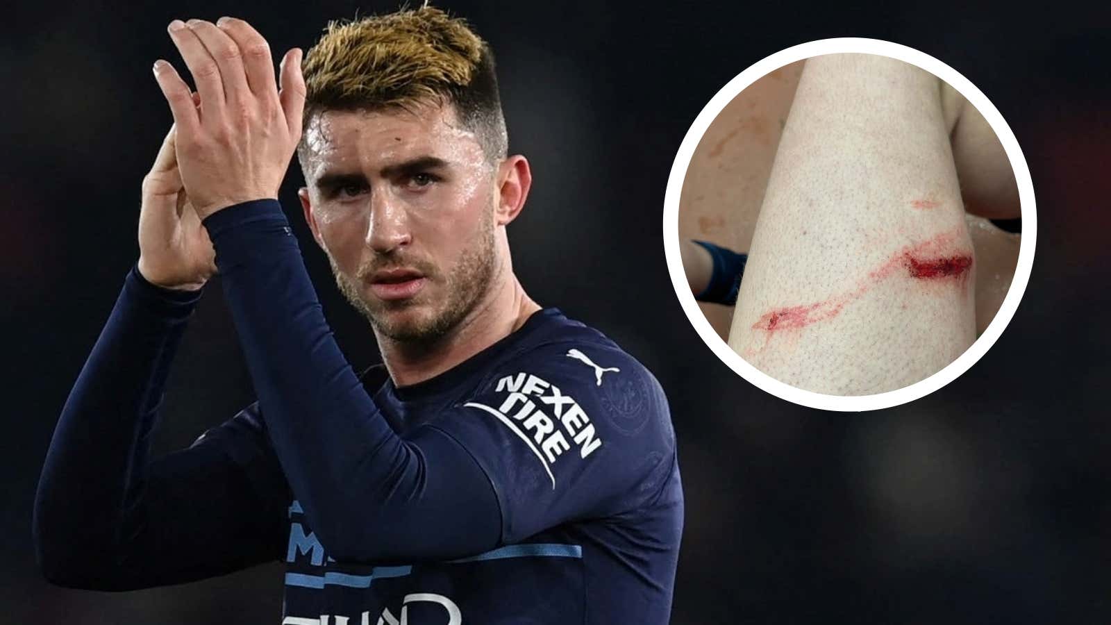 Aymeric Laporte and his wound