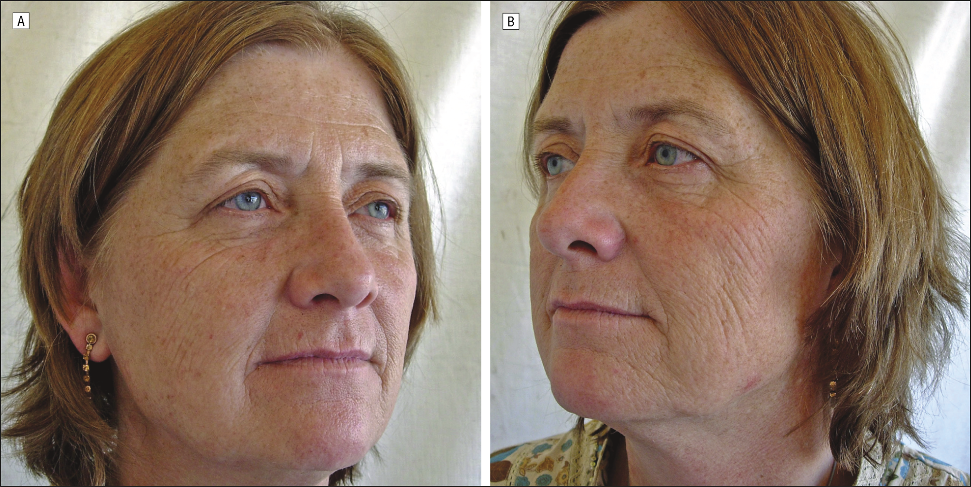 Shocking experiment shows major difference in appearance between twins  where one smoked and other didn't