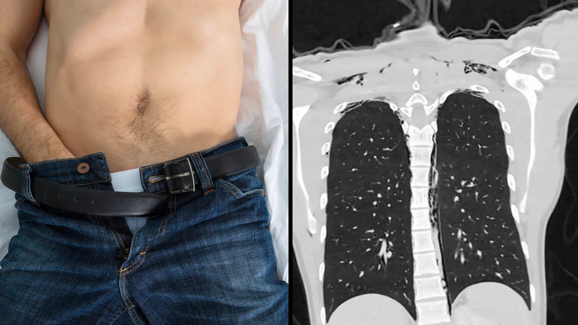 Man Rushed To Hospital After Suffering Horrific Injury From Overly Aggressive Masturbation - Vimarsana News