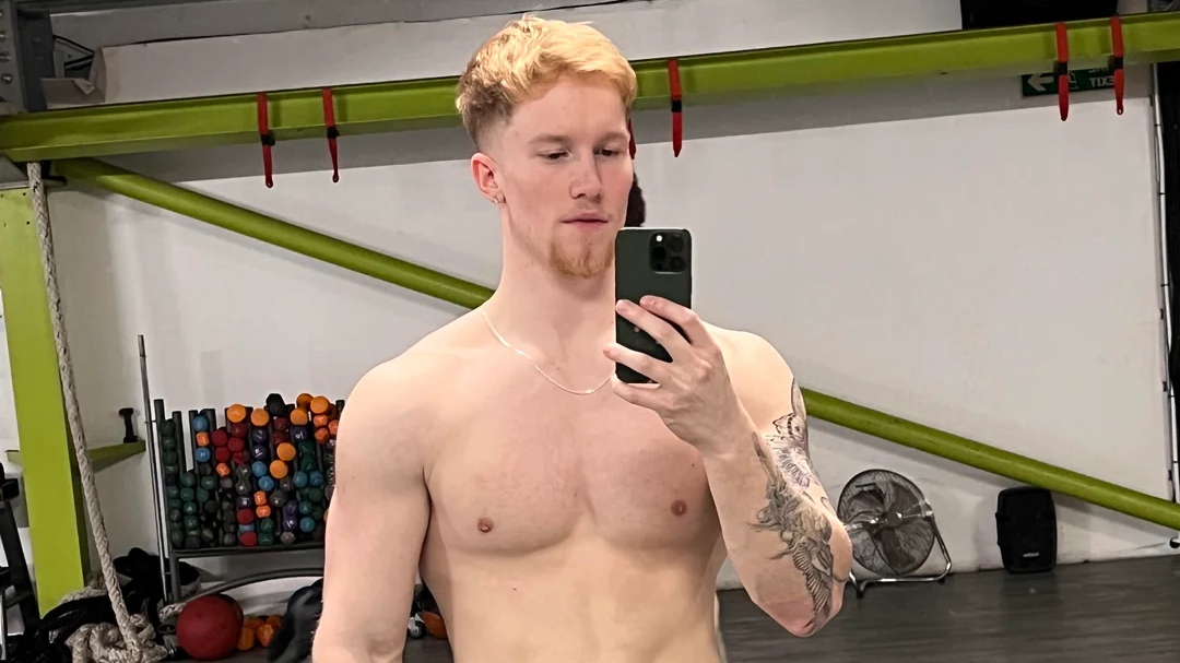 Man who's injected Melanotan II for years shares before and after photos