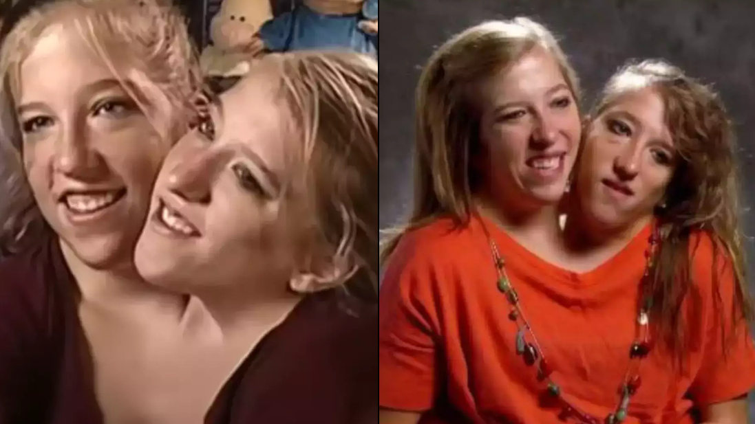 Conjoined Twins Paid Double Tuition at College But Receive Only One Salary as Teachers
