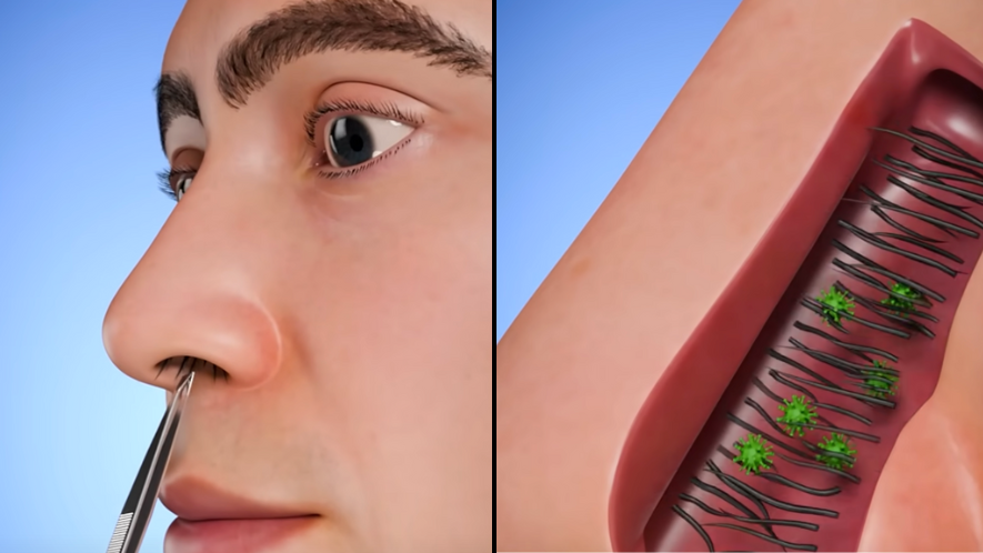 Nose hairs hotsell