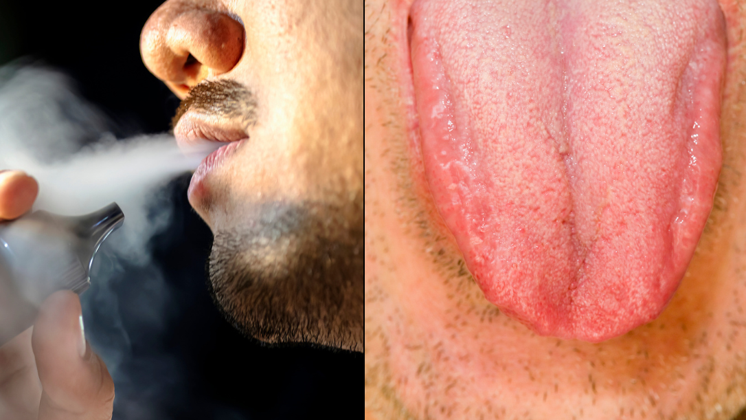 elfbar elfa master akku If You Vape, You Might Want To Keep An Eye On Your Tongue main image 1