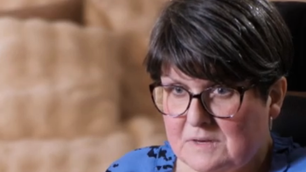 US woman living with Alice in Wonderland syndrome shows