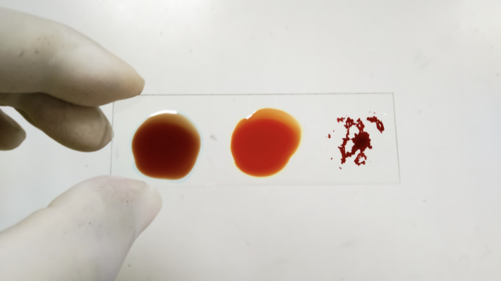 Scientists discover new blood type only found in one woman on earth today