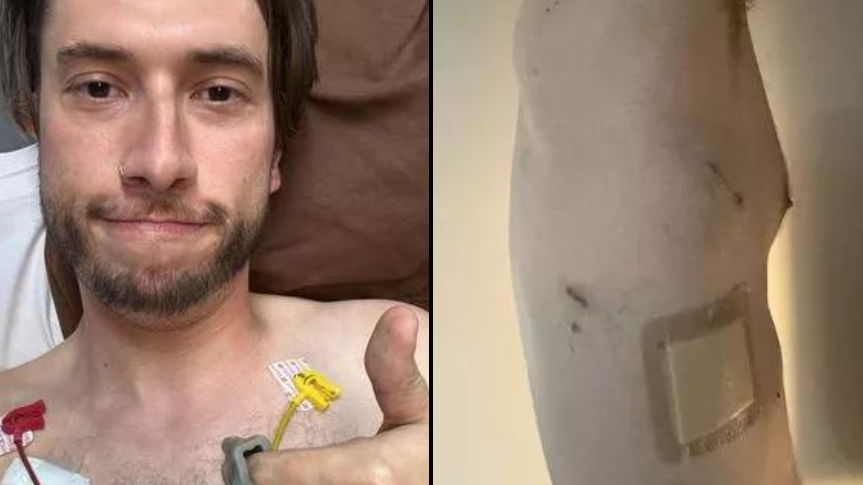 vape slots Vaper experiences alarming symptom before lung collapses after bubble  bursts inside of him