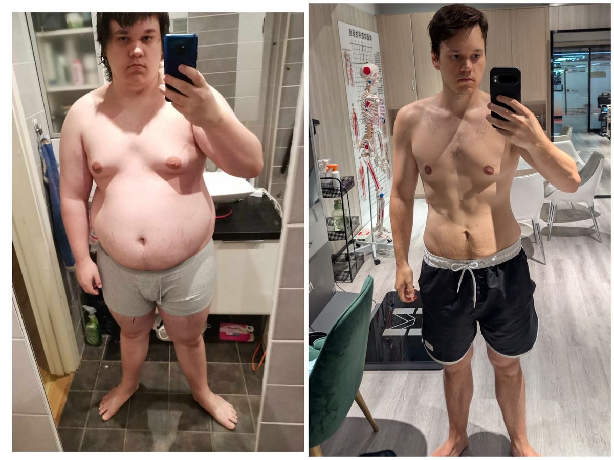 melanotan 2 before and after pictures results II (With Pictures) melanotan peptide before and after