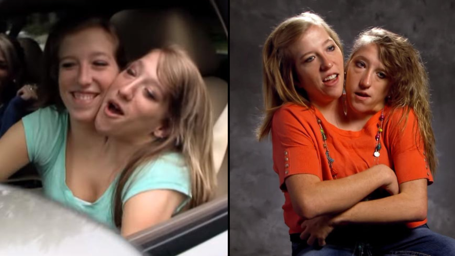 Conjoined twins Abby and Brittany Hensel gave explanation to how they drive a car