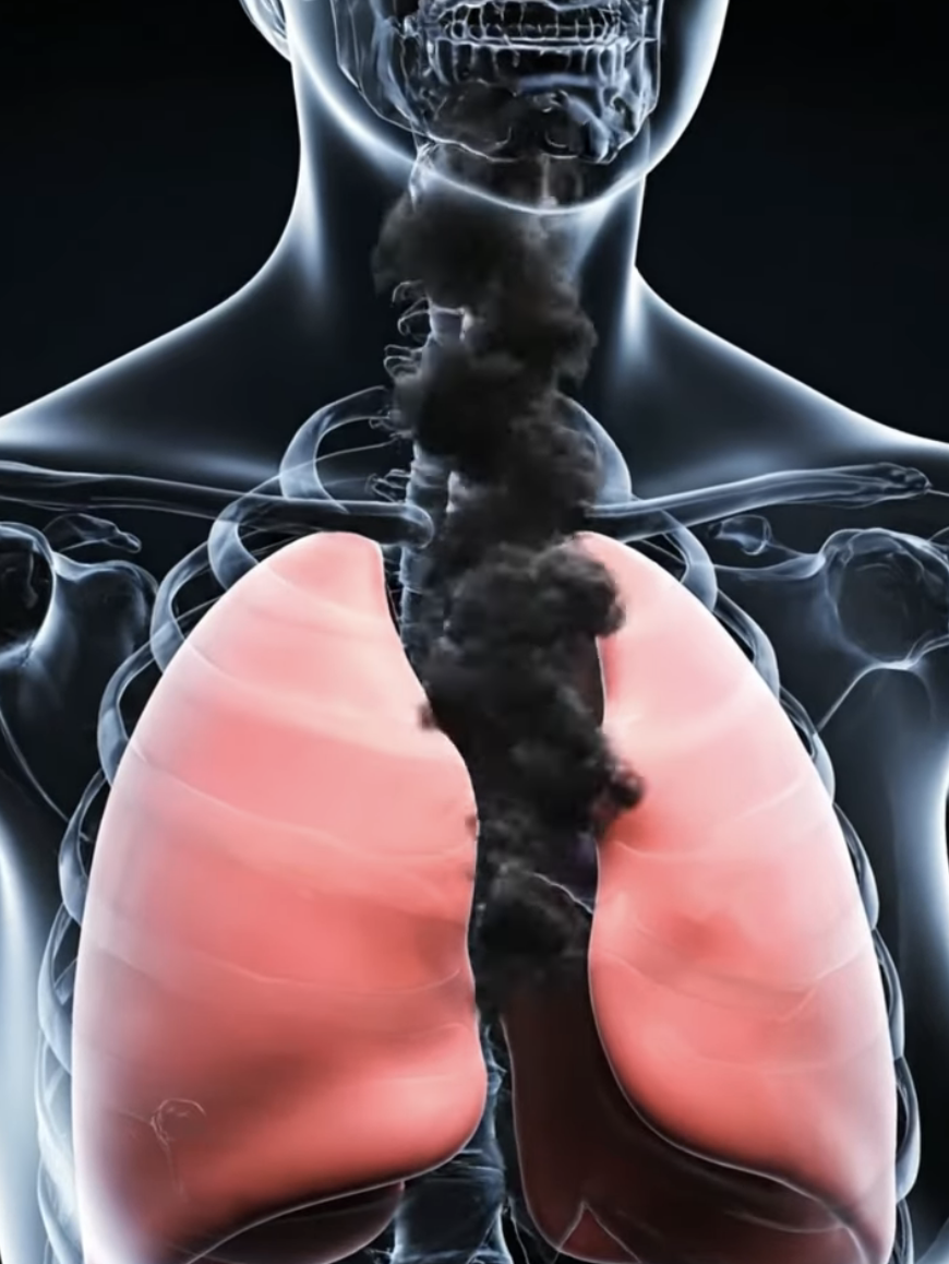 will menthol cigarettes crystalize your lungs in space Menthol flavoring in e-cigarette condensate causes pulmonary Vaping, Environmental Toxicants Exposure, and