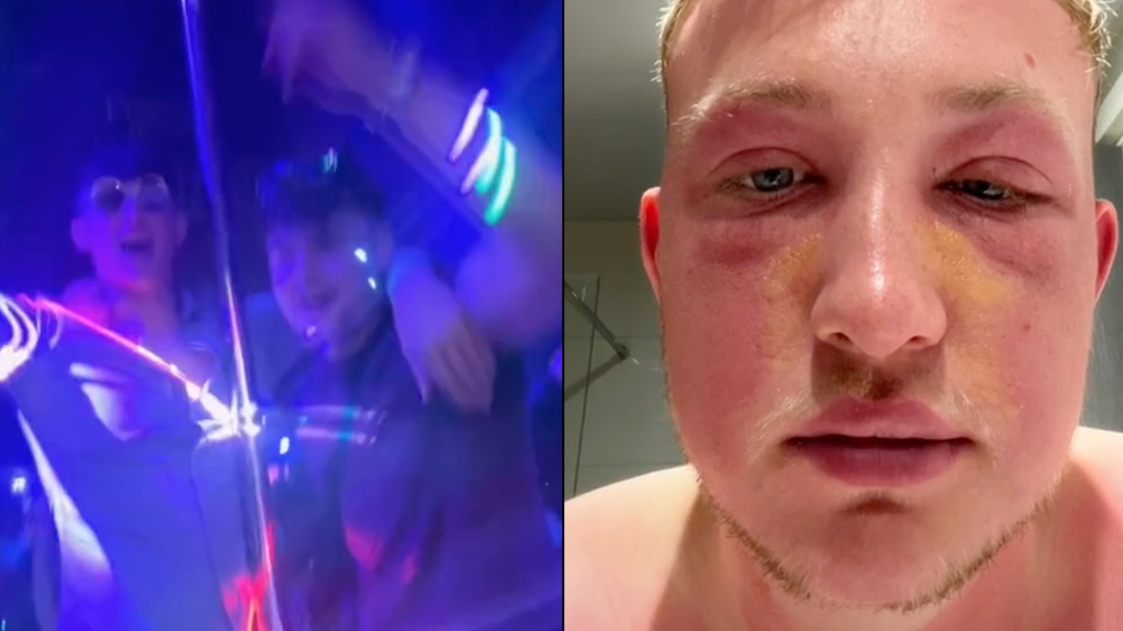 Lad Goes On Night Out On Holiday And Wakes Up Naked On Random Hotel Roof - Vimarsana News